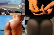 ACRÍLICO NO BUMBUM - “Não tem cura”, diz nova vítima de falsa médica