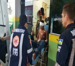 NA CABEÇA - Apenado é baleado em bar na zona Leste