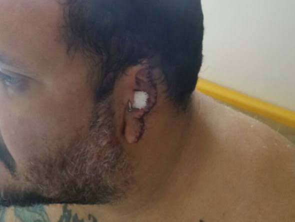 BRUTALIDADE: Homem é preso após arrancar orelha de foragido durante bebedeira