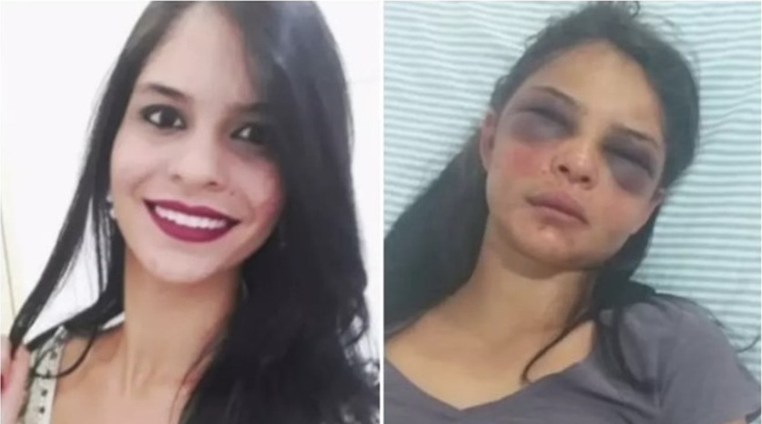 INDEFESA: Mulher fica com rosto desfigurado após apanhar e ficar 36h amarrada