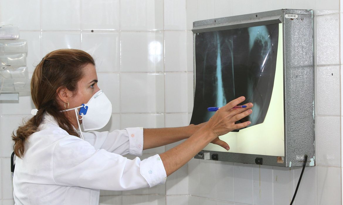 PREOCUPAÇÃO: Brasil registra 200 casos de tuberculose por dia, segundo dados do Ministério da Saúde